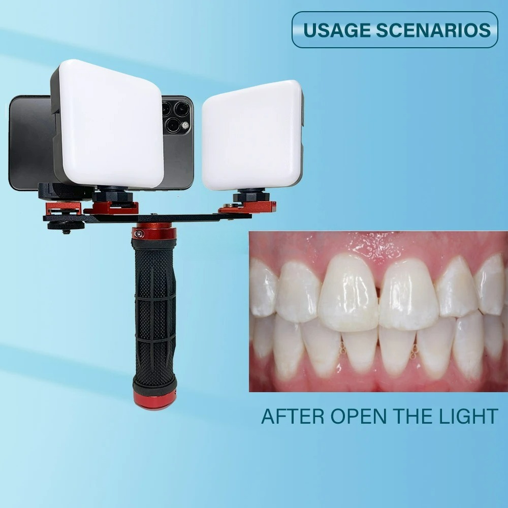 Diş Hekimleri İçin Bluetooth'l - Phone Accessories For Photography incelemesi ve fiyatı